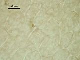 8 – Cellule midollari e cellule secretrici inserite sulla cellula supporto